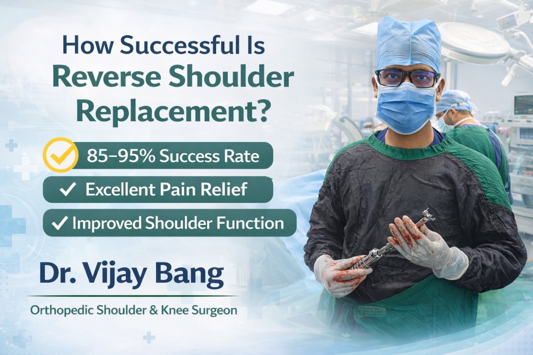 Reverse shoulder replacement in Ahmedabad
