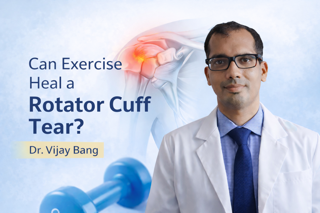 rotator cuff shoulder doctor in ahmedabad