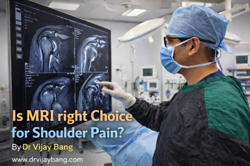 best shoulder surgeon in ahmedabad