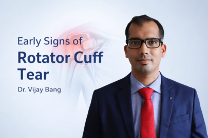 best rotator cuff shoulder orthopedic doctor in ahmedabad