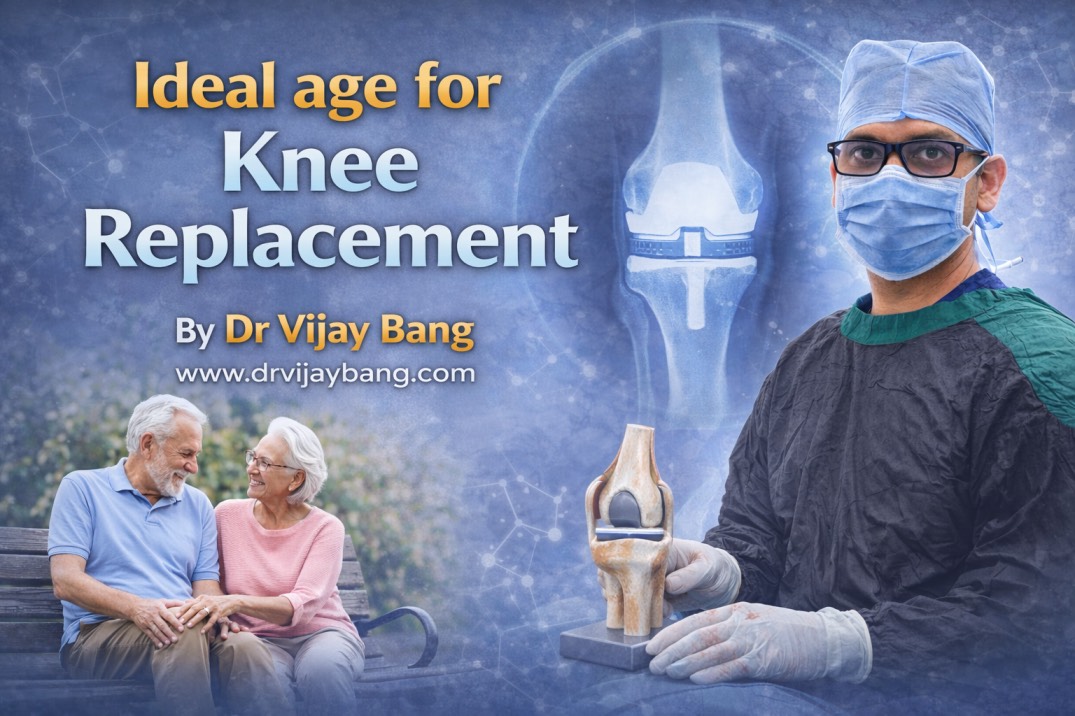 best knee replacement doctor in ahmedabad