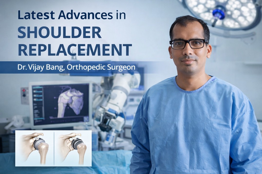 shoulder replacement doctor in ahmedabad explains latest advancements
