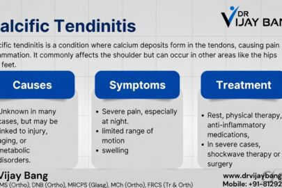 calcific tendinitis treatment in Ahmedabad by Dr Vijay Bang, shoulder specialist in Ahmedabad , gold medalist, Switzerland return 10000+ surgeries, writer of the shoulder pain book, BANG SHOULDER INSTITUTE