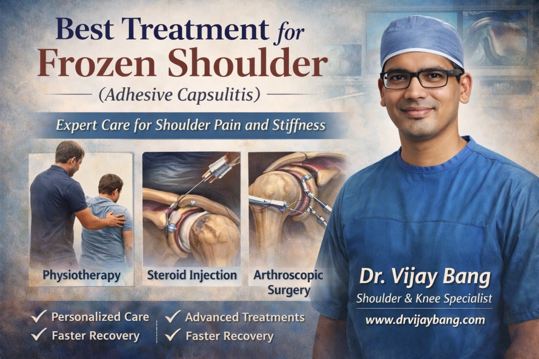 frozen shoulder treatment in ahmedabad