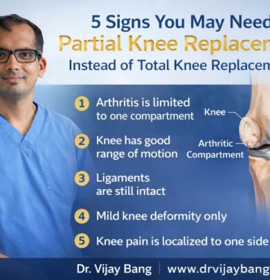 partial knee replacement in ahmedabad