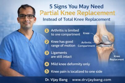 partial knee replacement in ahmedabad