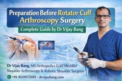 preparations before arthroscopic shoulder arthroscopic rotator cuff tear repair surgery treatment in ahmedabad by dr Vijay Bang, shoulder specialist in ahmedabad , gold medalist, Switzerland return, best rotator cuff tear treatment surgeon in ahmedabad