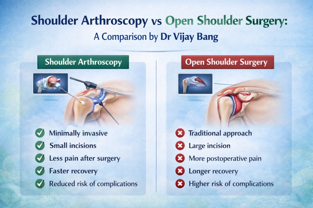 shoulder arthroscopy vs open shoulder surgery dr vijay bang shoulder expert ahmedabad, gold medalist, Switzerland return author The shoulder pain book, best shoulder specialist in ahmedabad