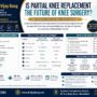 Is Partial Knee Replacement the Future of Knee Surgery? (2026 Complete Guide)