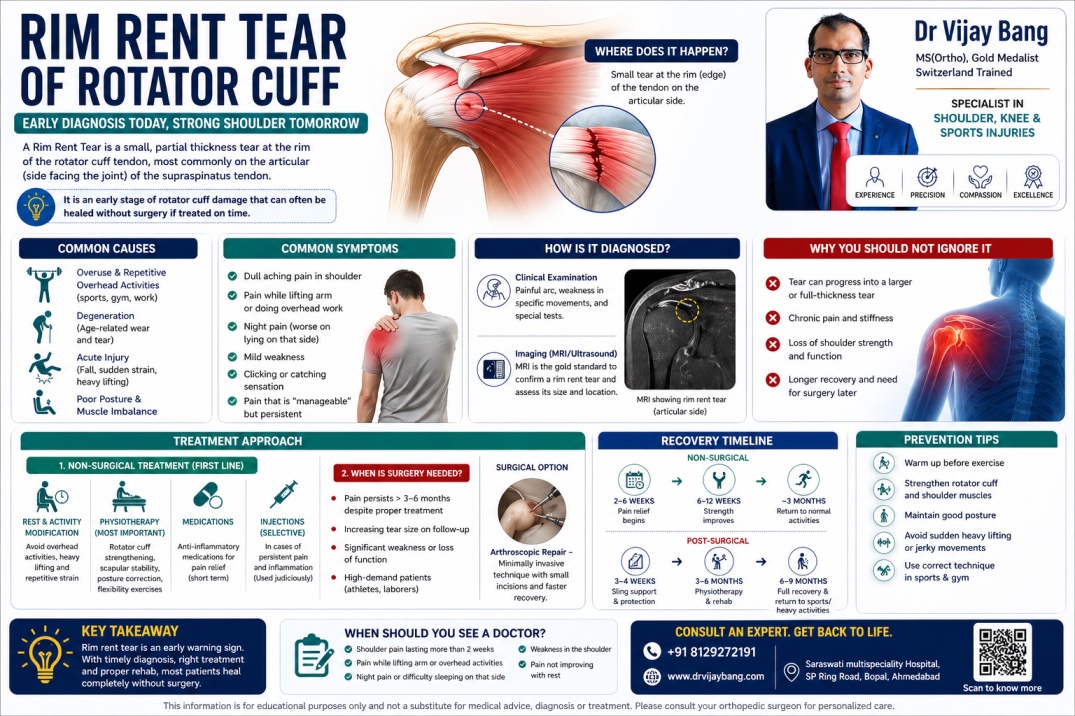 rim rent tear in ahmedabad dr vijay bang