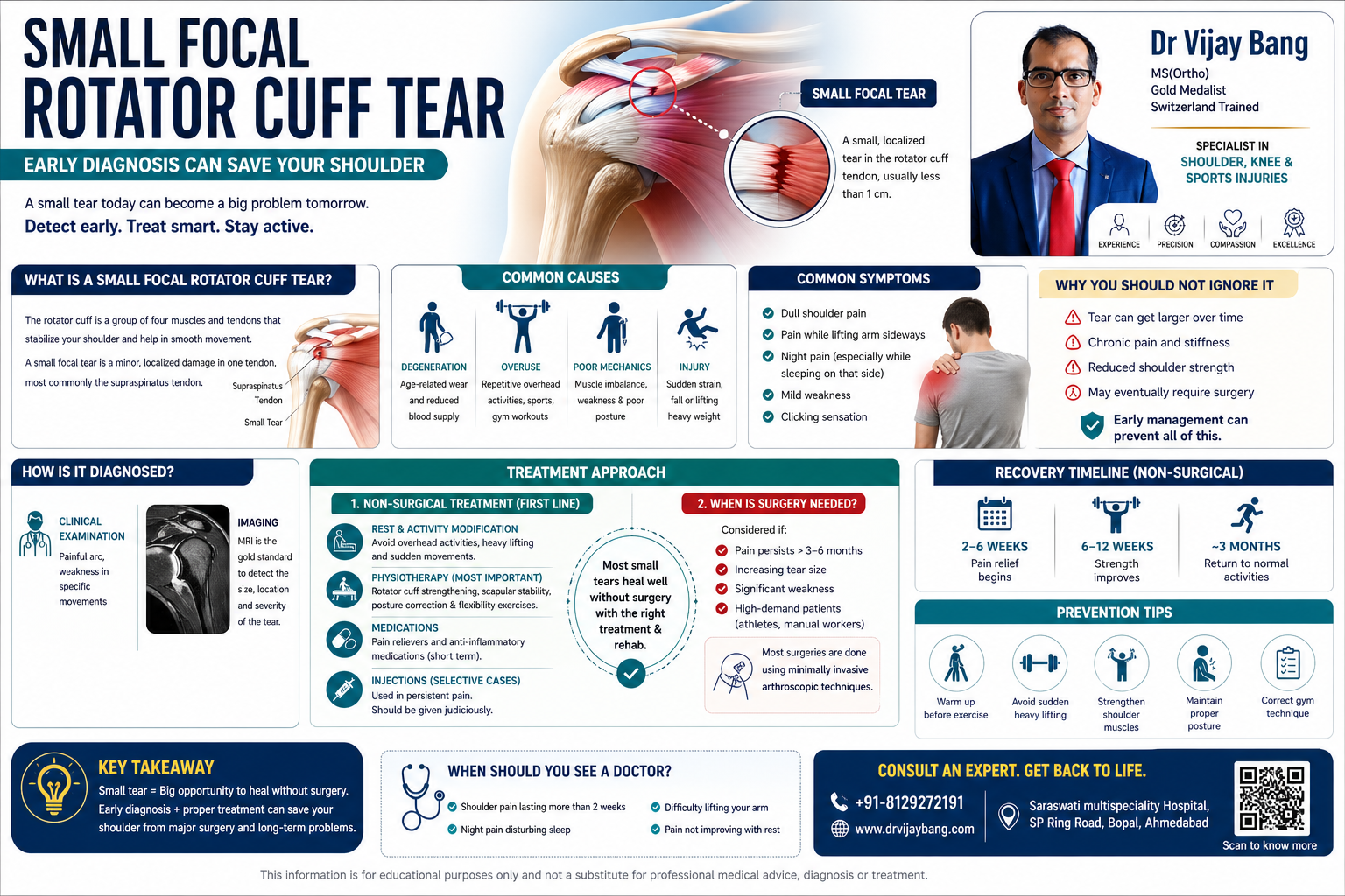 small rotator cuff tear treatment in ahmedabad dr vijay bang, shoulder orthopedic surgeon in Bopal, Ahmedabad