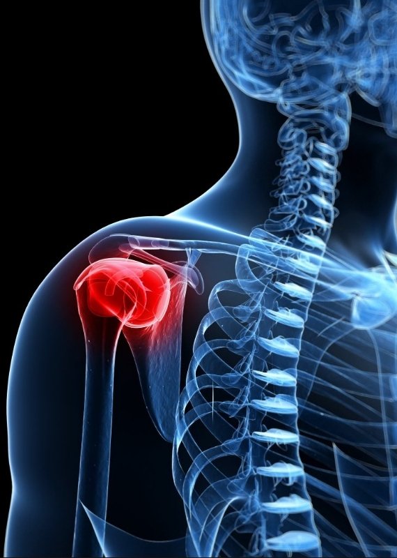 Clinical evaluation for frozen shoulder diagnosis